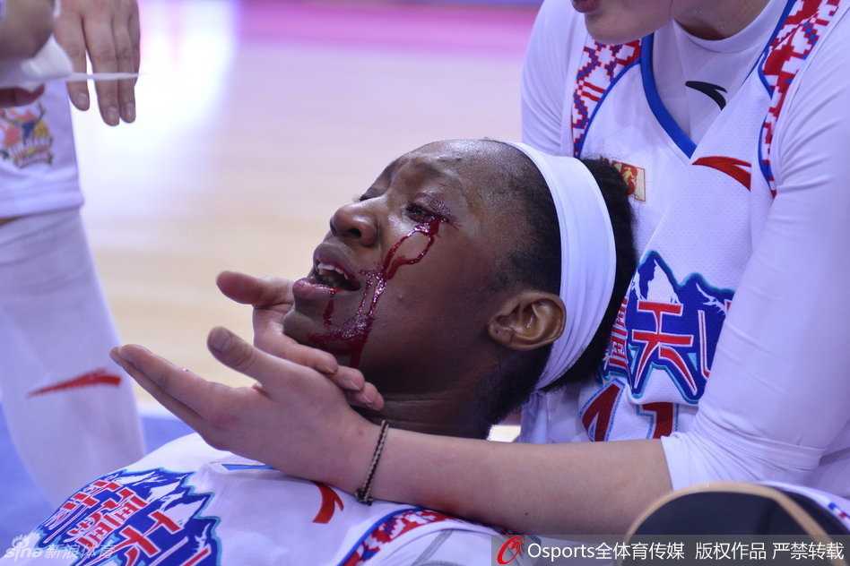赛场地板上的血迹触目惊心，见证了这场总决赛的残酷与惨烈，也见证了查尔斯战斗到最后一刻的英勇。