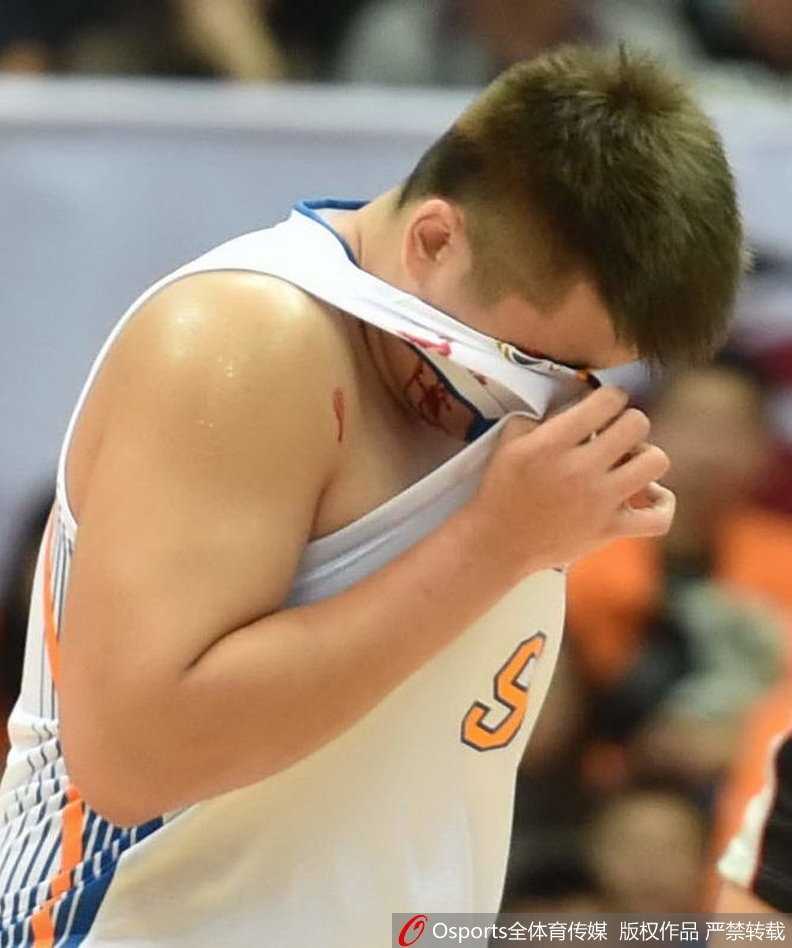 眉骨开裂血染战袍 四川内线徐煜峰浴血奋战的夜晚 队医用厚厚的纱布紧紧按住徐煜峰伤口,徐煜峰表情痛苦却依然保持站立,等待进一步处理