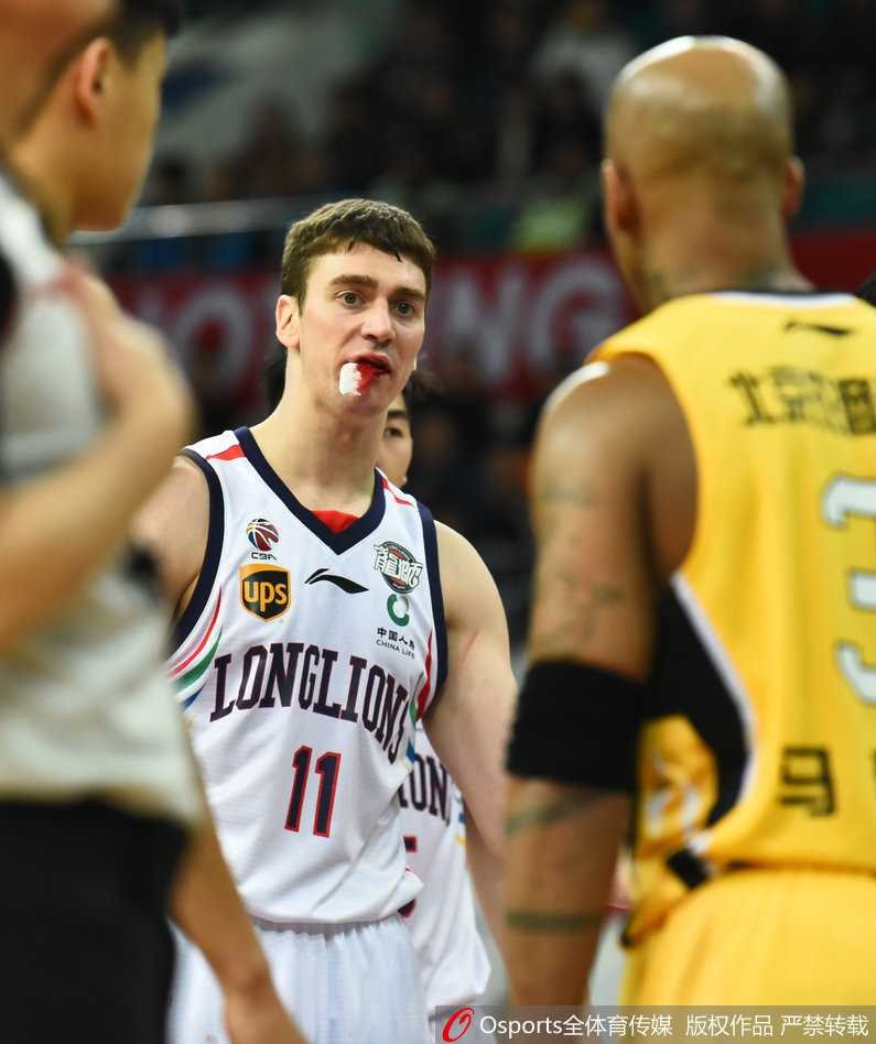 汉斯布鲁嘴角被撞开裂，殷红的鲜血顺着下巴流淌，但他的眼神依然坚毅地盯着篮筐方向。