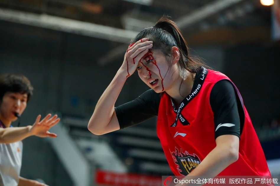 队医紧急为郭子瑄进行止血处理，从特写镜头可以看到伤口情况较为严重，但她紧咬牙关，默默承受着剧痛。